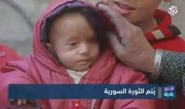 أنّات الأطفال وصرخات الجوعى تعود مجددا من الغوطة الشرقية، والطائرات الروسية والسورية تواصل قصفها للمدنيين المحاصرين. 

تقرير التلفزيون العربي