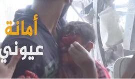 أمانة عيوني .. طفل سوري فقد عينيه في جريمة لقوات الأسد بالغوطة الشرقية بثاني أيام عيد الفطر