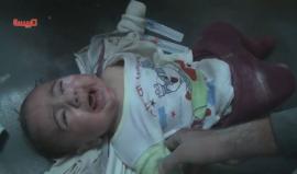 مشهد مؤثر .. طفل رضيع أصيب بقصف قوات النظام السوري على قرية الفرحانية بريف #حمص الشمالي