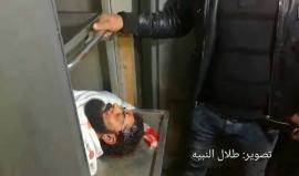 #شاهد جثمان الشهيد المقعد إبراهيم ابو ثريا في مستشفى الشفاء، وهو مبتور القدمين اصيب برصاص بالراس بمواجهات شرق غزة اليوم .