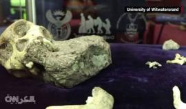 #شاهد.. ورم سرطاني في عظام أحفورة عمرها أكثر من مليون عام