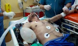 #عاجل إصابة مواطن من ذوي الاحتياجات الخاصة برصاص الاحتلال بالرأس وحالته خطيرة، شرق جباليا شمال قطاع غزة . 
تصوير محمد المصري