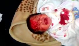 مشهد مؤلم لطفلة رضيعة أصيبت بالقصف على #حلب المحاصرة 
(نشطاء)
