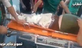 #شاهد وصول عدد من الاصابات للشبان المشاركين في مسيرات العودة لمستشفى شهداء الأقصى وسط قطاع غزة
تصوير: حازم مزيد