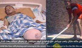 #شاهد جريمة الاحتلال بحق الطفل (محمد رائد أبو حسين) سكان مخيم جباليا شمال غزة