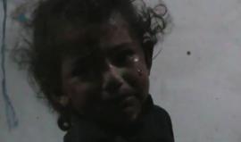 مشهد مؤثر لطفلة سورية أصيبت بقصف طائرات الأسد على أحياء #درعا البلد