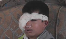 ريف دمشق- مناشدة مدير الهيئة الطبية في بلدة مضايا المحاصرة لإخراج الطفل أيهم برهان للعلاج