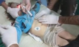 المشاهد الأولية للمجزرة المروعة التي ارتكبتها طائرات الأسد بحق المدنيين وسط مدينة #بنش بريف إدلب
تقرير معاذ الشامي