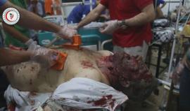 ننصح عدم متابعة الأطفال " 18+ " 
#شاهد .. 3 شهداء وعدد من الجرحى اثر غارات جوية اليوم الجمعة استهدفت مدينة دوما بريف دمشق .