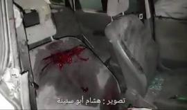 فيديو - استشهاد الشاب المقدسي "مصطفى نمر" واعتقال آخر بعد إصابته برصاص الاحتلال في مخيم شعفاط بالقدس المحتلة بحجة وإدعاء محاولتهما تنفيذ عملية دهس بسيارة

تصوير: هشام أبو سنينة