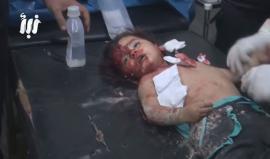 #تحذير: ينصح عدم مشاهد الأطفال يحتوي على مشاهد قاسية ..
ارتقاء أطفال جراء قصف قوات النظام السوري لمدينة #درعا 
تصوير: نبأ