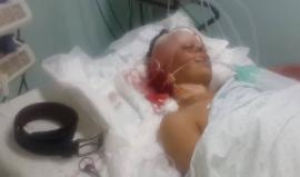 #شاهد مستشفى غزة الأوروبي جنوب القطاع ينشر مقطع لفتى مصاب برصاص الاحتلال مجهول الهوية