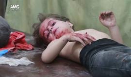 مشاهد قاسية لضحايا القصف على حي بستان القصر في #حلب