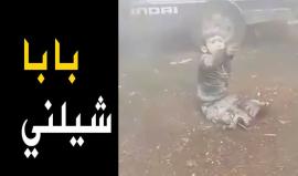 "بابا شيلني يا بابا" .. صرخات طفل تقطعت أطرافه بصواريخ روسيا التي تساقطت على ريف #إدلب اليوم .
 لكن الأب عجز عن حمل معاناة طفله !