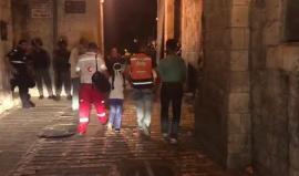 #شاهد
إصابة طفلة بالرأس واليد بعد قمع الاحتلال للمصلين على أبواب المسجد #الأقصى المبارك
