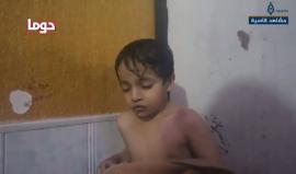 #شاهد مجزرة جديدة بالكيماوي .. تحصد أرواح عشرات الأبرياء في دوما