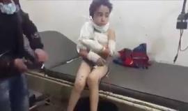 #شاهد| ضحايا القصف بالكلور السام على حي الكلاسة في #حلب المحاصرة