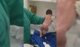 #شاهد الرضيعة المعجزة تمشي بعد دقائق من ولادتها !