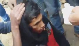 #شاهد .. إصابة شاب بشظايا رصاصة في رأسه خلال المواجهات مع قوات الاحتلال قرب السياج الفاصل شرق مدينة غزة أمام موقع "ناحل عوز" العسكري . 

تصوير باسل زينو