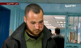 #شاهد| آثار الإصابات التي تعرض له الفلسطينيون في #غزة خلال مسيرة العودة 
تقرير: محمد منصور