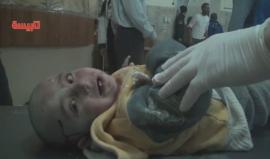 مشهد مؤثر لطفل سوري أصيب بقصف قوات الأسد على ريف #حمص الشمالي