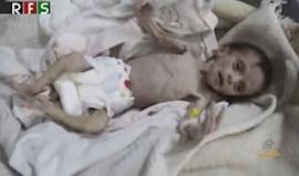 الوضع الصحي يدق ناقوس الخطر ووفيات ناتجة عن نقص الغذاء والدواء في #الغوطة_الشرقية
#الأسد_يحاصر_الغوطة 
#AssadBesiegesGhouta