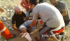 #شاهد | فلسطيني يجلس بكل هدوء رغم إصابته برصاص الاحتلال اخترق قدميه شرق البريج وسط قطاع غزة.