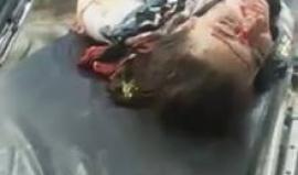 صرخات مؤلمة لطفلة أصيبت بقصف قوات النظام السوري على بلدة حيان بريف #حلب الشمالي مساء اليوم
(المكتب الاعلامي لبلدة حيان)