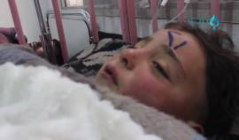 مشاهد لمصابين في مجزرة الكيماوي بمدينة #خان_شيخون بريف #إدلب
بلدي نيوز 
#سوريا