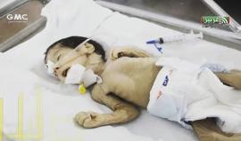 ماذا يريد المدنيون في الغوطة الشرقية ؟