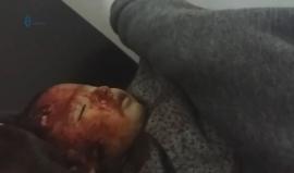 ننصح عدم مشاهدة الأطفال ..
إصابات خطيرة جراء قصف مدفعي للنظام السوري على بلدة مضايا بريف دمشق
