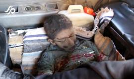 مشاهد قاسية .. 
#شاهد | غارات عنيفة قبل قليل على حي الوعر المحاصر في حمص والعديد من الشهداء معظمهم أطفال وعدد كبير من الجرحى .