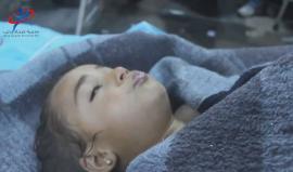 ننصح عدم مشاهدة الأطفال "18+" 
#شاهد | النظام السوري يرتكب مجزرة مروعة بالغاز السام راح ضحيتها أكثر من 70 شهيدا معظمهم أطفال و 250 إصابة، في غارات استهدفت خانشيخون بريف #إدلب 
#خان_شيخون_تختنق
#Idlib