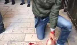 شاهد وحشية المستوطنين ماذا فعلت .. 

#فيديو إصابة شاب فلسطيني بجروح بعد اعتداء مستوطنين عليه أمام باب السلسلة أحد أبواب المسجد الأقصى