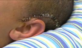 #فيديو الاحتلال يفرج عن الطفل الجريح محمد فضل التميمي بعد اعتقاله فجر اليوم من منزله في النبي صالح شمال غرب رام الله

فيديو يوصف حالة الطفل بعد اصابته