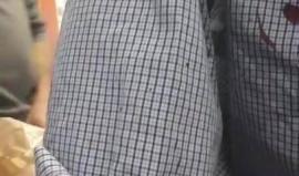 إصابة المواطن تيسير النوري من حواره بعد تعرضه للاعتداء من قبل 20 مستوطن يهودي