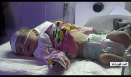 سوء الأوضاع واشتداد البرد يزيدان التهاب القصيبات في شمال سوريا