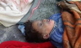 مشاهد قاسية.. استشهاد عائلة سورية مكونة من 6 أشخاص بحي الصاخور في #حلب جراء قصف ببرميل متفجر يحوي غاز الكلور السام 
تصوير: ثائر محمد - مركز حلب