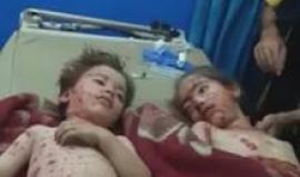 مشاهد مؤثرة لأطفال أصيبوا بقصف قوات الأسد والطيران الروسي على بلدة حيان بريف حلب الشمالي 
مشاهد قاسية +18