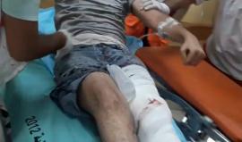 #شاهد رسالة من أحد جرحى مسيرة العودة اليوم للمنتقدين للمسيرة وللاحتلال
تصوير: اسلام الرن