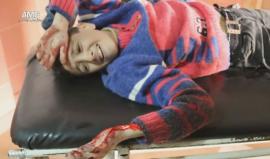 ننصح عدم مشاهدة الأطفال "18+" 
شهداء وجرحى اثر القصف الروسي الجوي بالقنابل العنقودية على أحياء الفردوس والسكري في #حلب المحاصرة ظهر اليوم.

تصوير: خليل حجار