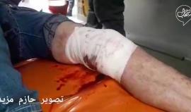 #فيديو تواصل نقل الاصابات جراء اعتداء الاحتلال على مسيرة العودة شرق البريج