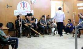 مركز «فرحة» يعمل على تركيب الأطراف الصناعية لمتضرري الحرب في الغوطة الشرقية