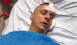 #شاهد مستوطن من " سديروت" مصاب من صواريخ المقاومة: خرجنا من منزلنا ملطخين بالدماء