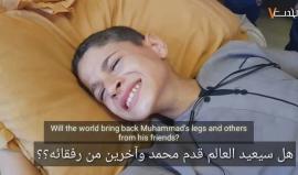 إجرام الاحتلال الممنهج يتعمد استهداف الأطفال في #مسيرة_العودة بغزة 
تصوير مثنى النجار