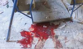 قذيفة من قوات الاسد تغتال أطفال روضة بريف دمشق !