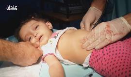 طفلة سورية قضت في قصف روسي على مدينة #حريتان بريف #حلب الشمالي
تصوير: عدنان مدلج (مشاهد قاسية +18)