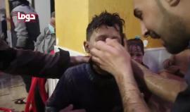 #عاجل.. مشاهد لضحايا القصف الكمياوي على مدينة دوما في الغوطة الشرقية