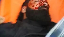 حرمه الاحتلال من قدميه قبل 9 سنوات.. #شاهد اللحظات الأولى لاستشهاد الشاب إبراهيم أبو ثريا شرق مدينة #غزة في "جمعة الغضب".