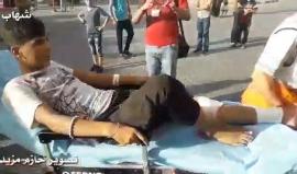 #شاهد من الإصابات التي تصل مستشفى شهداء الاقصى وسط قطاع غزة من بينهم سيدة، بفعل اعتداءات قوات الاحتلال على المتظاهرين .